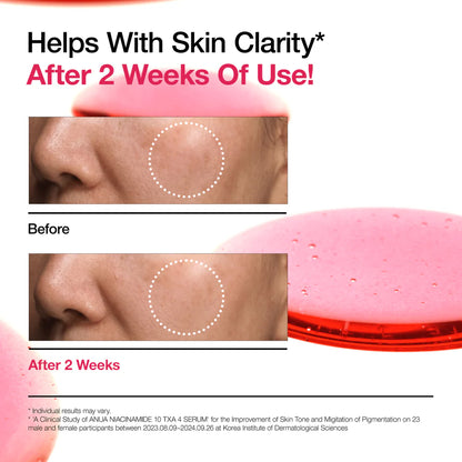Anua Niacinamide 10% + TXA 4% (Set of 2 x 30mL each)